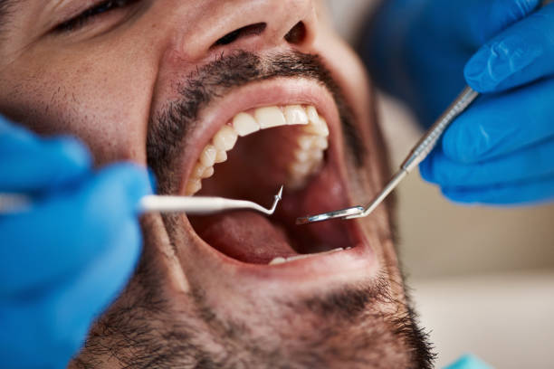 Best Emergency Denture Repair in Offutt Af, NE